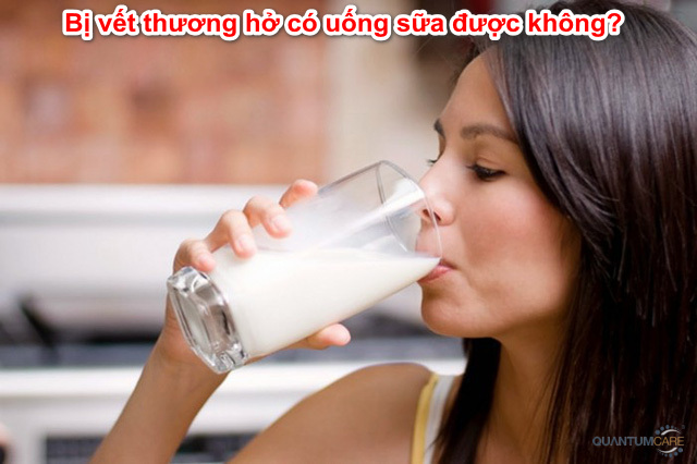 Bị vết thương hở có uống sữa được không? có kiêng kị gì?