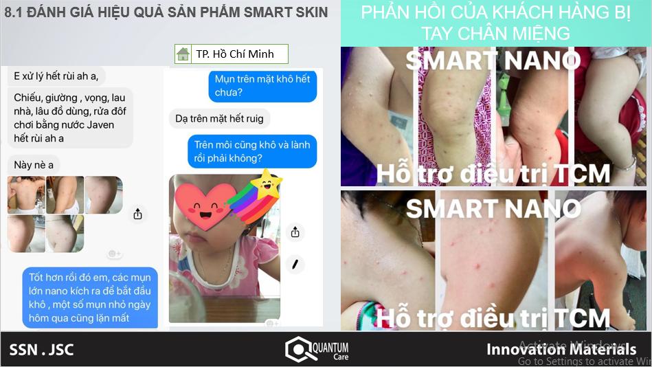 feedback-ve-san-pham-smart-skin-doi-voi-benh-tay-chan-mieng
