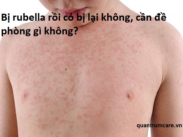 Riêng đối với phụ nữ mang thai, rubella có ảnh hưởng đến thai nhi không?
